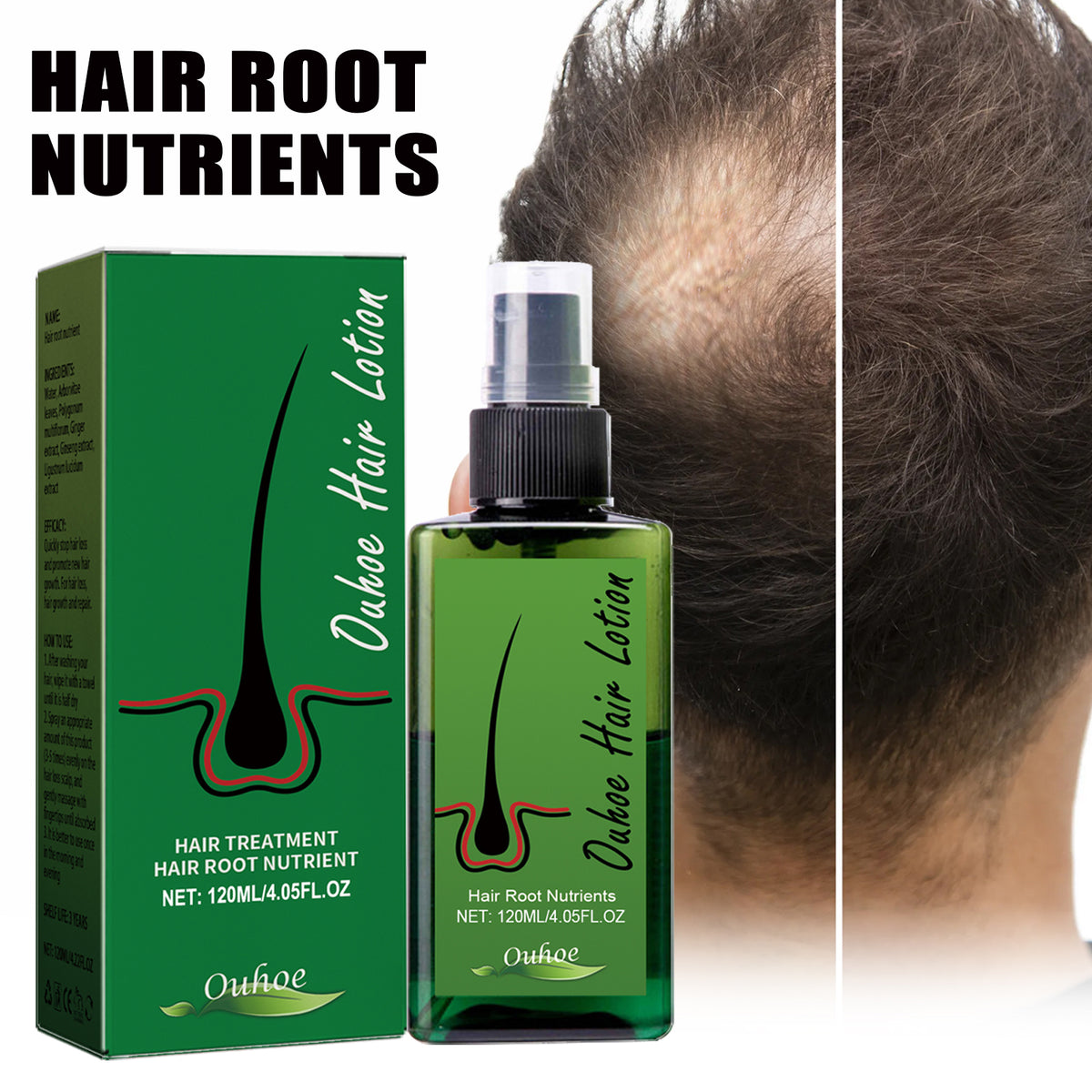 OUHOE Dense Hair Spray, Anti-Loss Hair Strengthening Hair Repair Hair Root Hair Care Spray