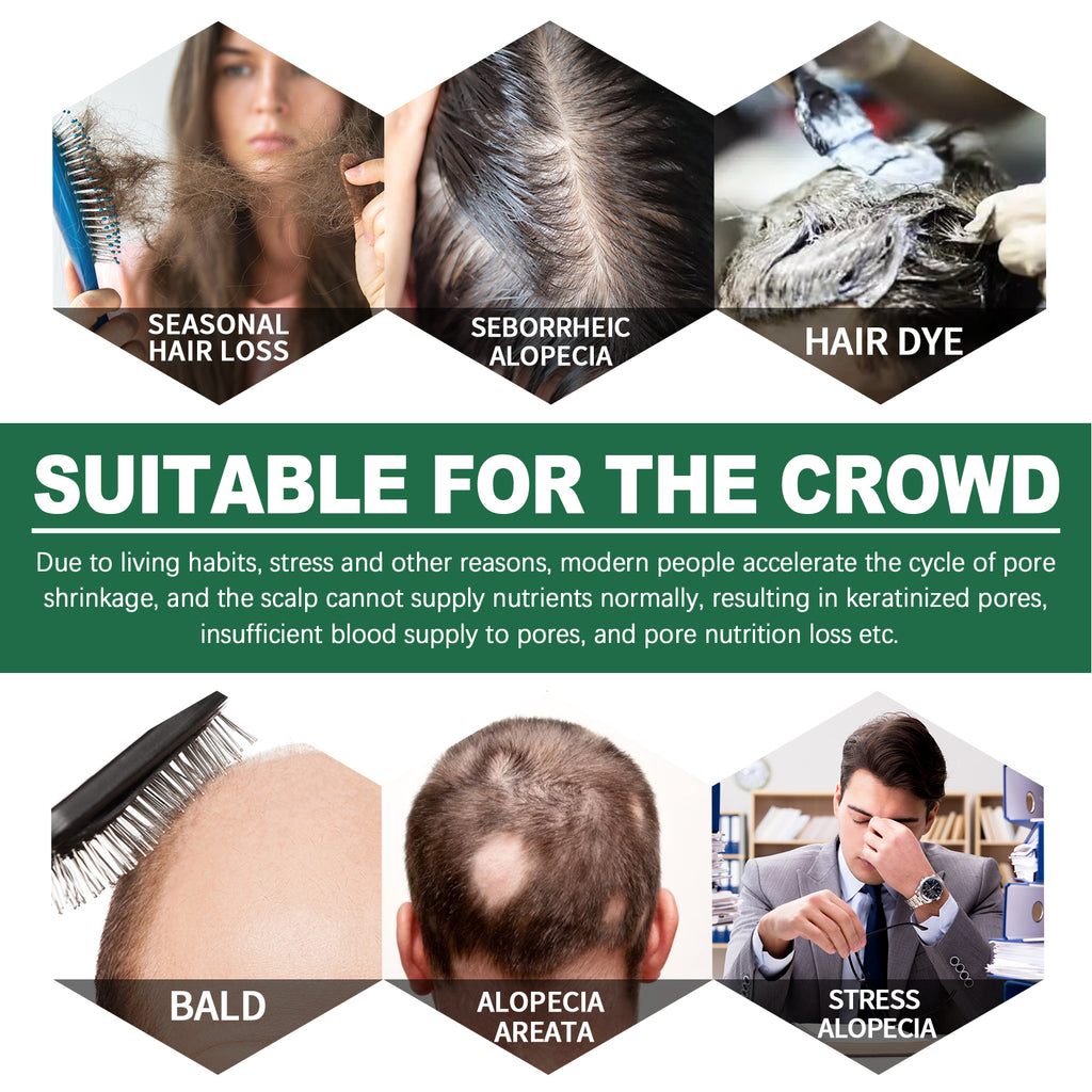 Hair Spray To Prevent Hair Loss, Moisturize, Strengthen And Thicken Hair And Scalp Massage Treatment Spray