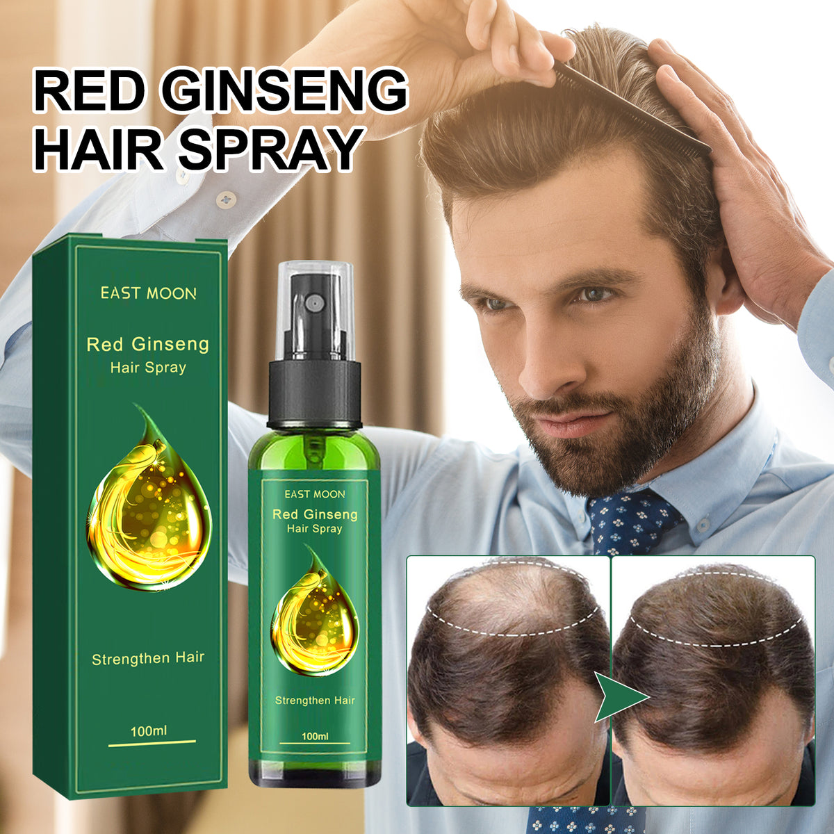 Hair Spray To Prevent Hair Loss, Moisturize, Strengthen And Thicken Hair And Scalp Massage Treatment Spray