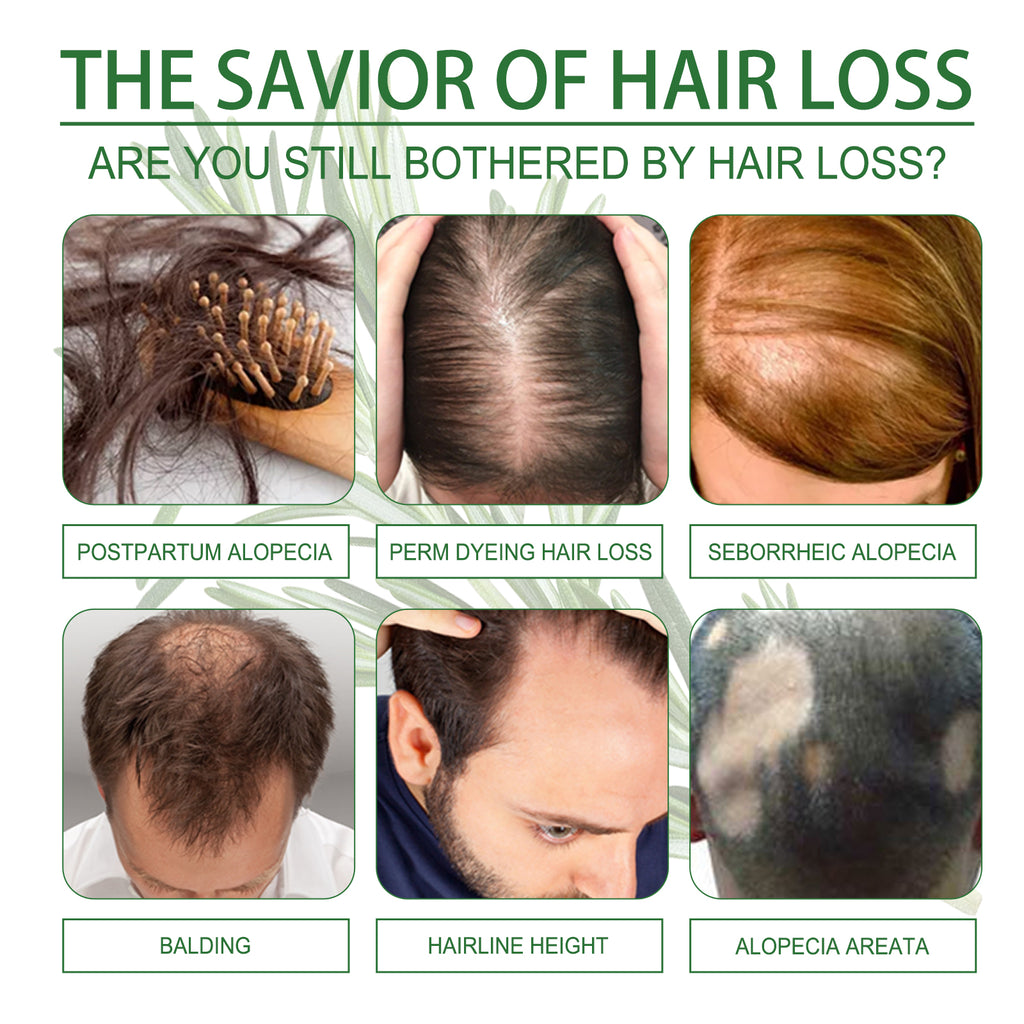Rosemary Hair Dense Essential Oil, Prevent Hair Breakage And Hair Loss Strong, Strong And Solid Hair Moisturizing Root Dense Essential Oil