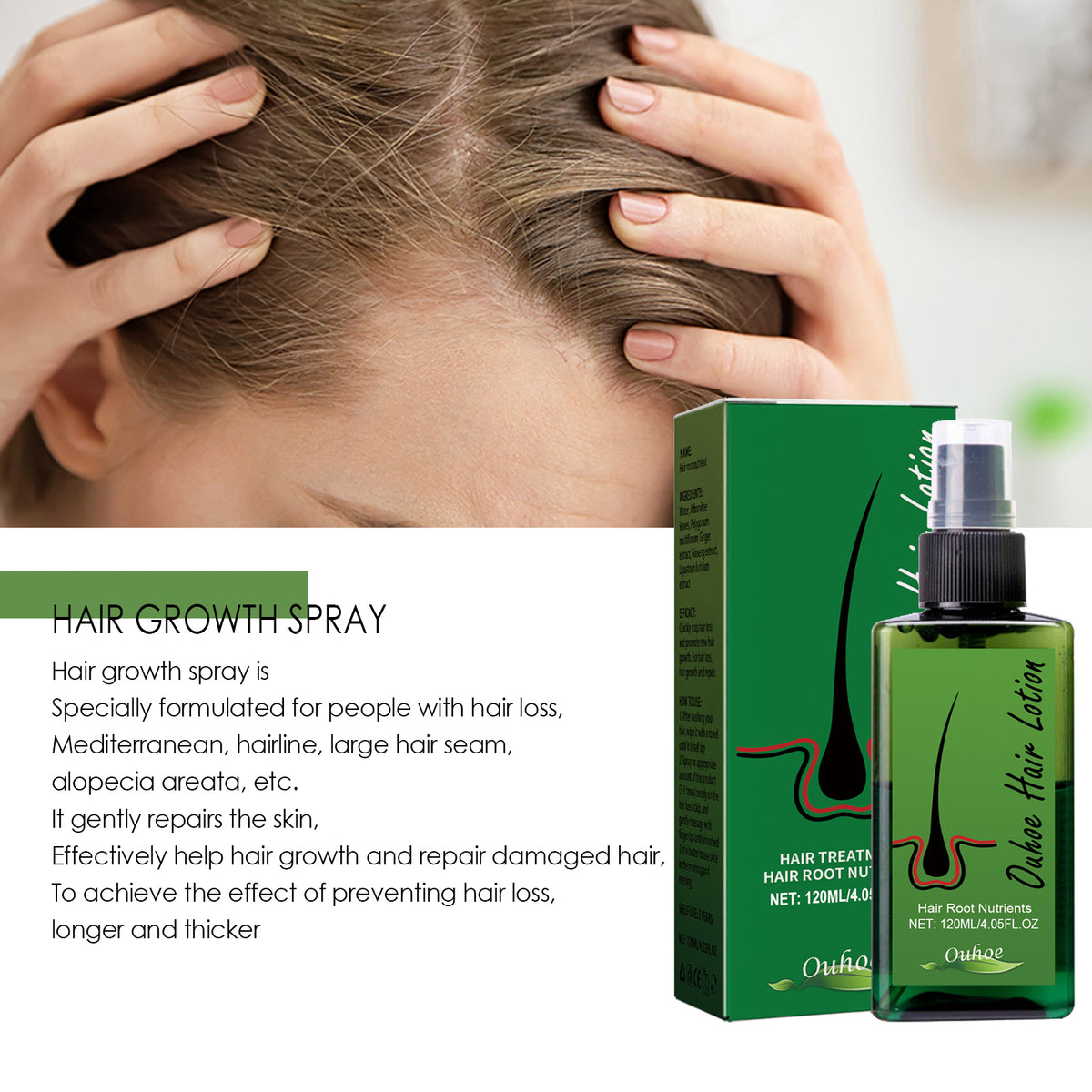 OUHOE Dense Hair Spray, Anti-Loss Hair Strengthening Hair Repair Hair Root Hair Care Spray