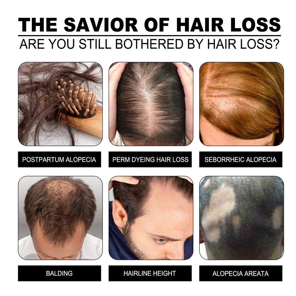 Tight Hair Shampoo Soap Strong Hair Tight Hair Anti-Loss Soft Repair Hair End Dry Damaged Shampoo Soap