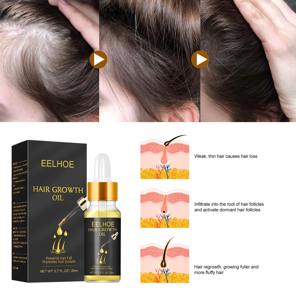 EELHOE Hair Growth Oil, Strengthens And Strengthens Hair Essential Oil Softens And Moisturizes Hair And Thickens Hair Nutrient Solution